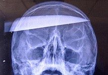 Chinês toma facada na cabeça por suposta trapaça em CS