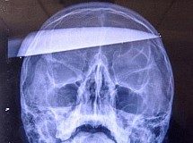 Chinês toma facada na cabeça por suposta trapaça em CS