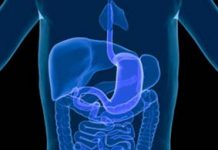 O diário delfiano da apendicite